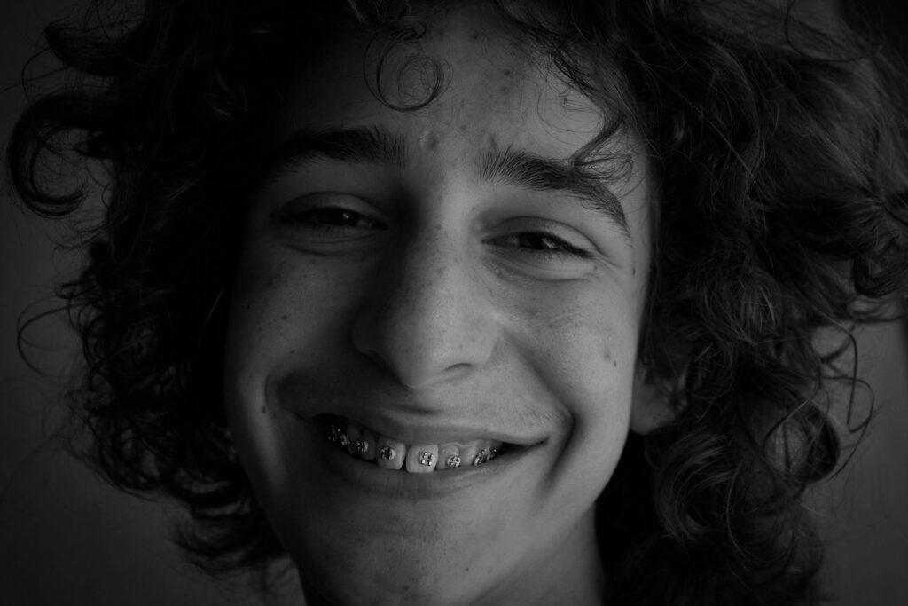 affordable braces in Tampa